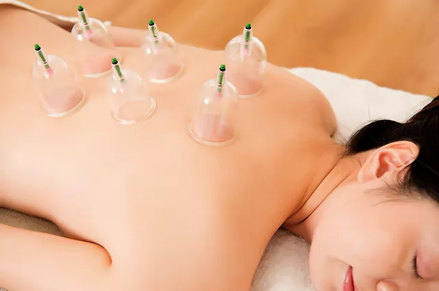 Sance de ventouses